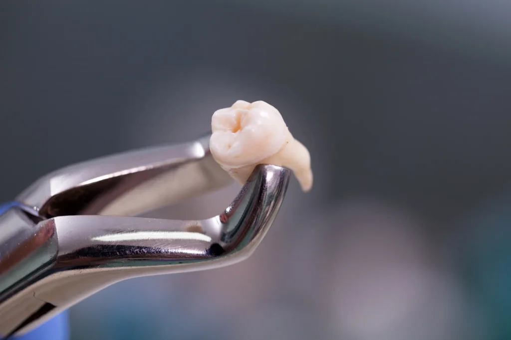 studio dentistico lettini a trani